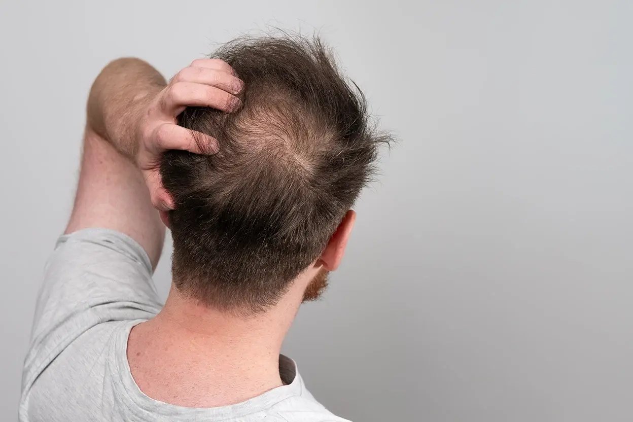 AAD - Hair conditions - Banner copy