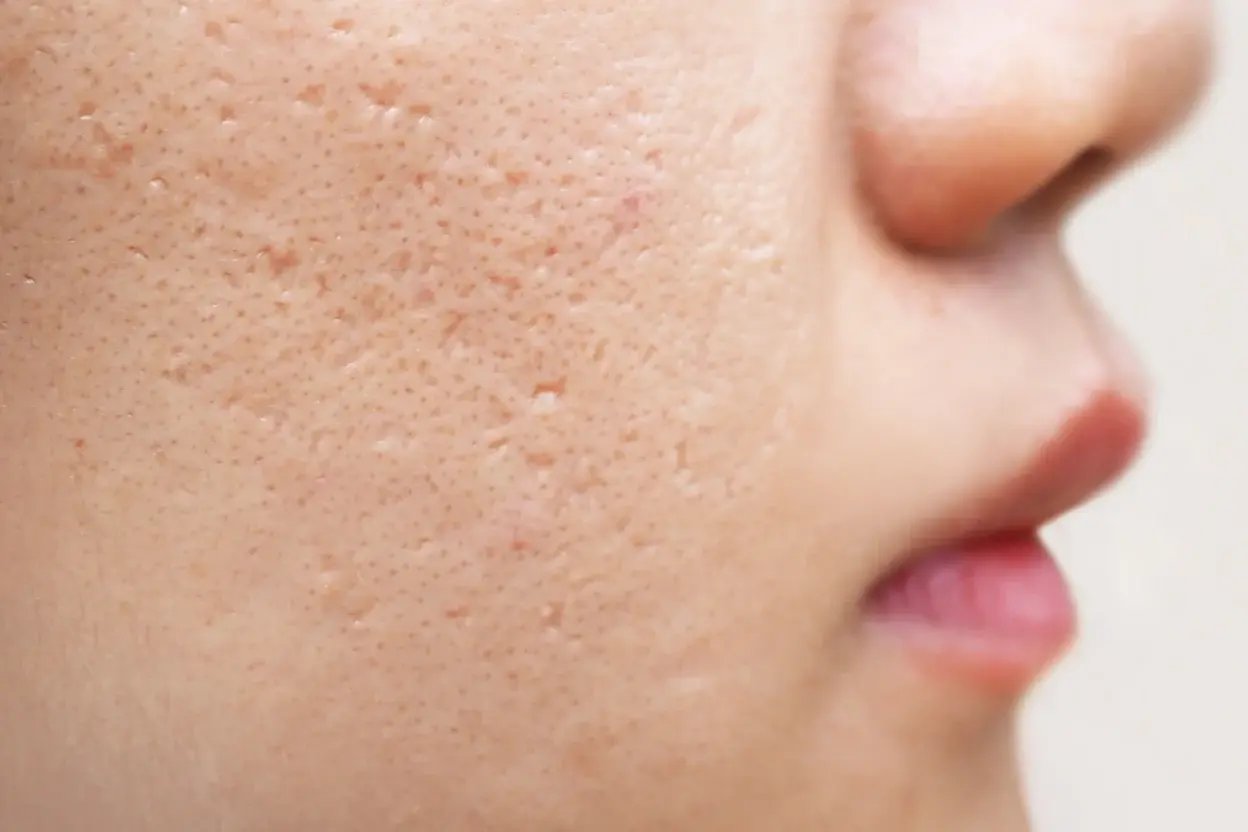 AAD - Scar & Skin Lesions - Banner copy