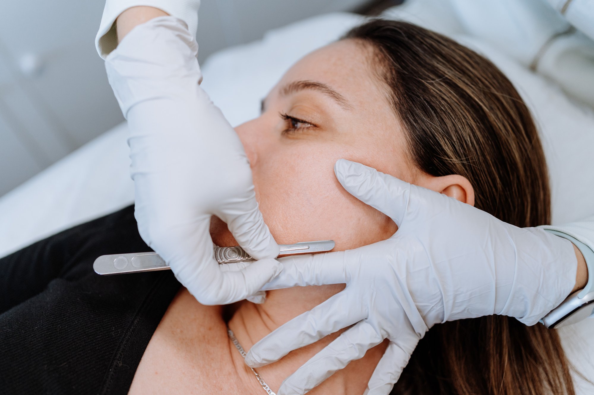 Aesthetics - Dermaplaning_iStock-1351582710