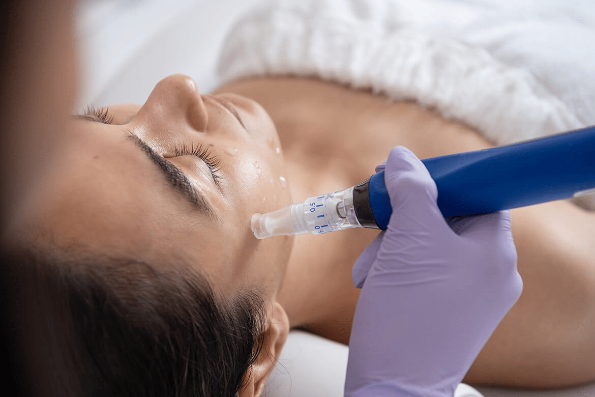 Aesthetics - Microneedling