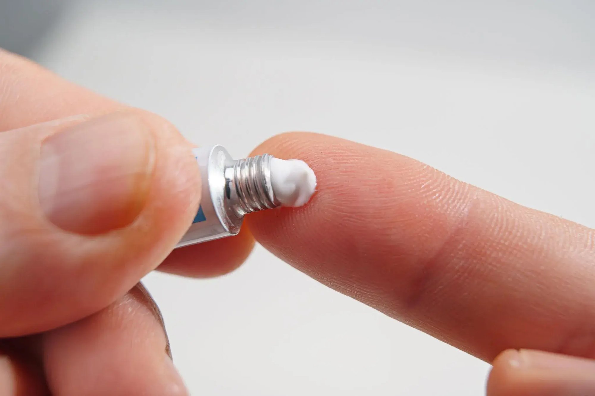 Skin Cancer - Topical Chemo