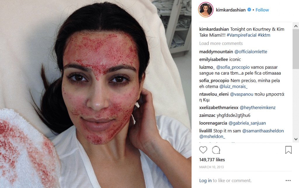 The Vampire Facial: Microneedling and Platelet-Rich Plasma (PRP)