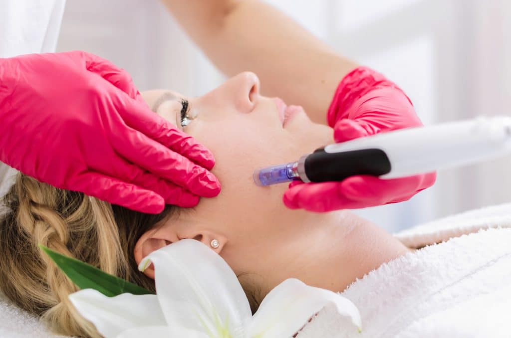 Microneedling: What You Need to Know