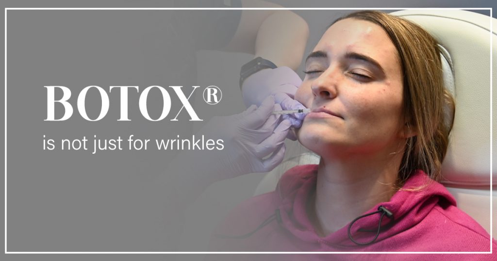 Women receiving Botox on upper lip for a lip flip