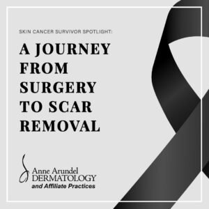 A JOURNEY FROM SURGERY TO SCAR REMOVAL