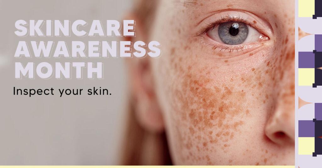 Young female face with freckles Skincare Awareness Month with text "Skincare Awareness Month. Inspect Your Skin"