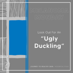 Jan16_Ugly-Ducking-Mole-IG