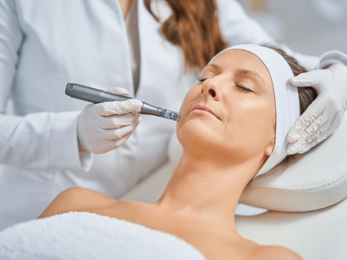 microneedling treatment on elder woman